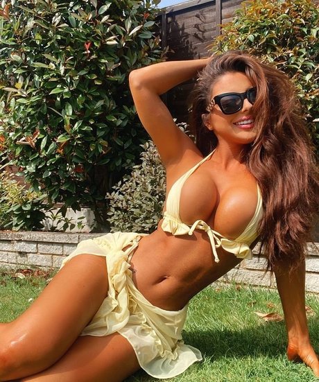 Misskayleighrosedematos