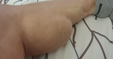 Laceysmuscularcalves