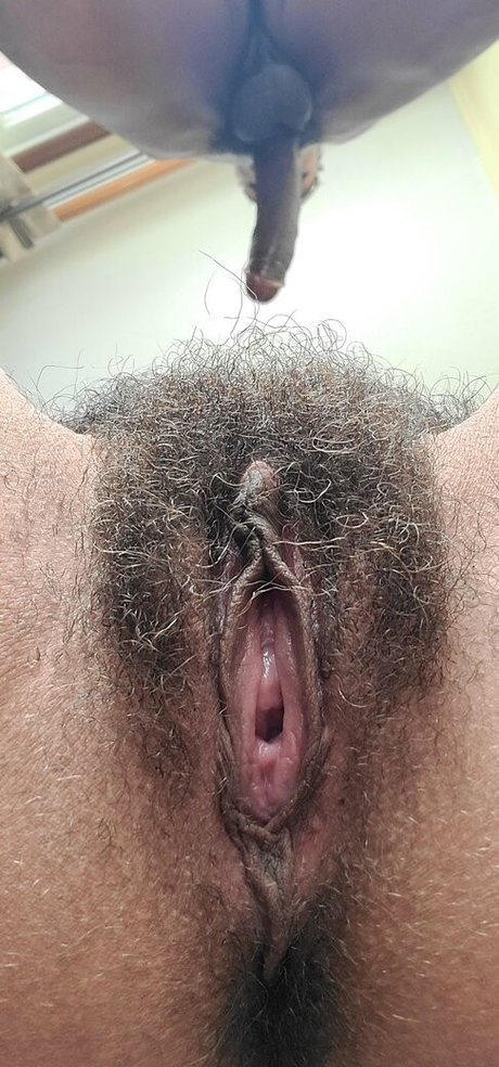 Hairy Women
