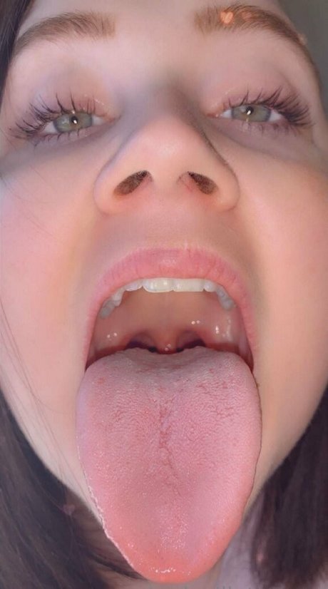 Toxicallietongue
